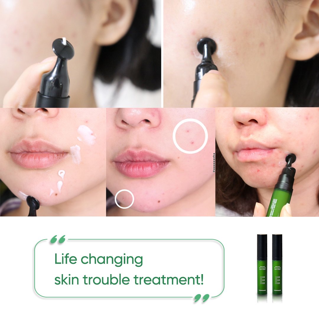 Commonlabs Vitamin E Micro Needle Spot Cream 10ml