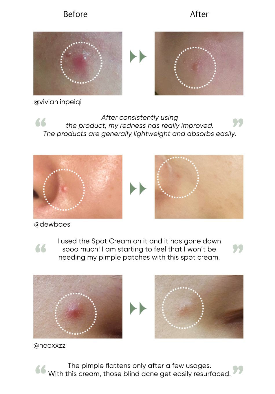 Commonlabs Vitamin E Micro Needle Spot Cream 10ml