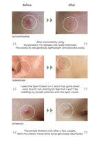 Commonlabs Vitamin E Micro Needle Spot Cream 10ml