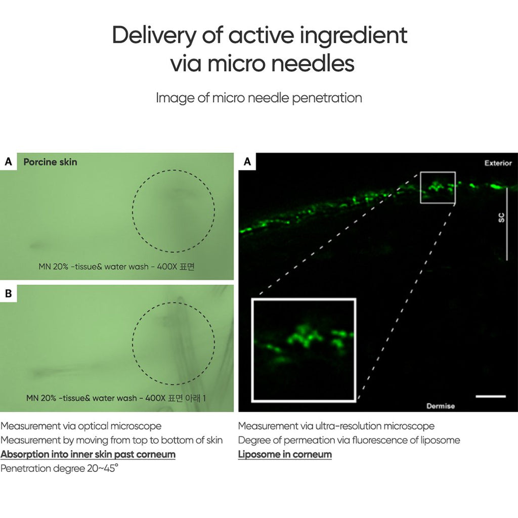 Commonlabs Vitamin E Micro Needle Spot Cream 10ml