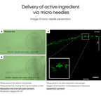 Commonlabs Vitamin E Micro Needle Spot Cream 10ml