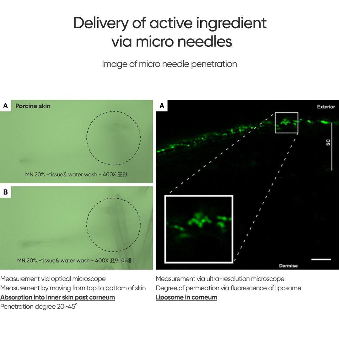 Commonlabs Vitamin E Micro Needle Spot Cream 10ml