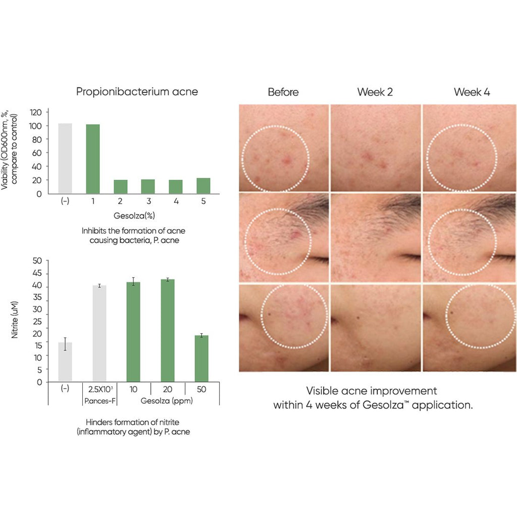 Commonlabs Vitamin E Micro Needle Spot Cream 10ml